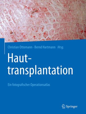 cover image of Hauttransplantation